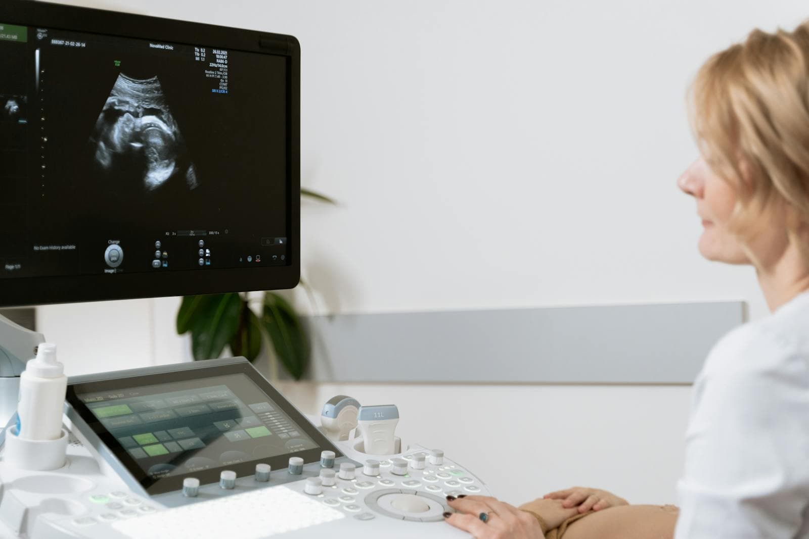 Healthcare professional performing a prenatal ultrasound scan on an ultrasound machine in a clinic
