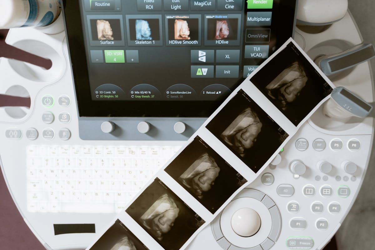 Ultrasound machine displaying 3D scan images with printed sonograms, showing the difference between medical and keepsake scanning