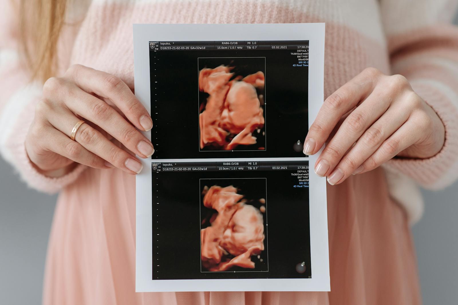 Pregnant woman holding detailed ultrasound scan printouts of her baby